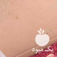 فروش زرشک پفکی و اناری در تهران