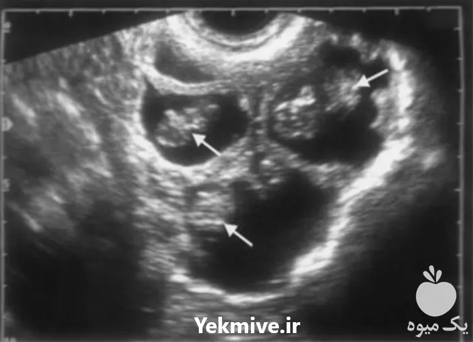 قیمت خرید سونوگرافی گوسفند و بز در تهران در گروه گاو و گوسفند و میش و بز کهره گوساله در یکمیوه -عکس1